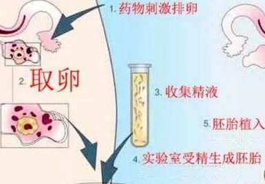 重庆三代试管助孕生子价格公布！单周期三代试管要6-8万